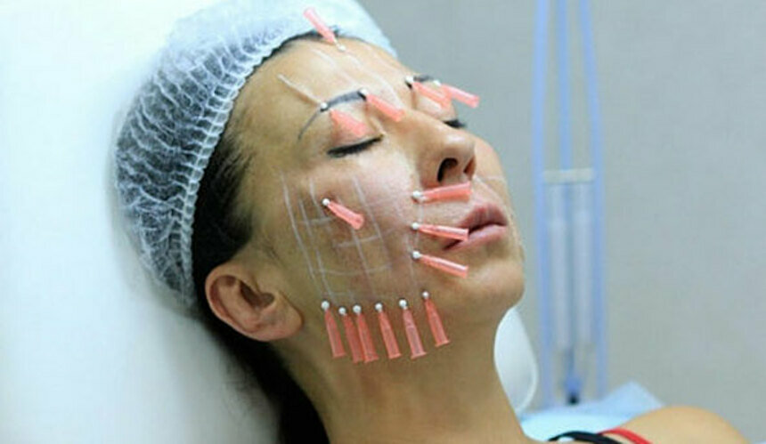 На грани косметологии и пластической хирургии: на что готовы женщины ради красоты - Новости Калининграда