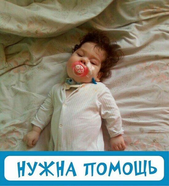 В Калининграде закрыли сбор для годовалой девочки, которая не может дышать и питаться самостоятельно - Новости Калининграда | Фото: &quot;Верю в чудо&quot;