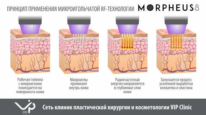 Что говорит наука о коже человека и какие современные процедуры ухода, по мнению врачей, дают лучший результат - Новости Калининграда