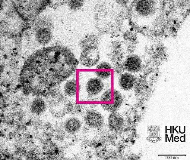 Учёные опубликовали электронную микрофотографию «омикрона» - Новости Калининграда | Фото: Гонконгский университет