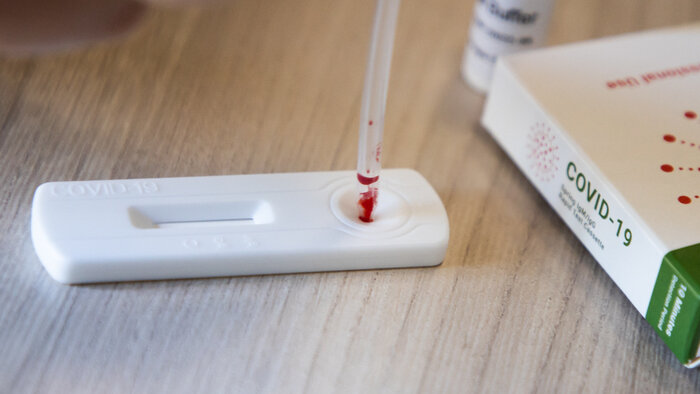 Экспресс-анализ крови на наличие антител не подойдёт | Фото: архив «Клопс»