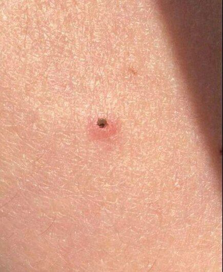 «У ребёнка рвота, поднялась температура»: в Калининграде на Ялтинской ...