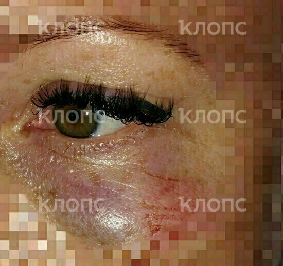 У женщины на лице огромный синяк | Фото предоставил муж пострадавшей