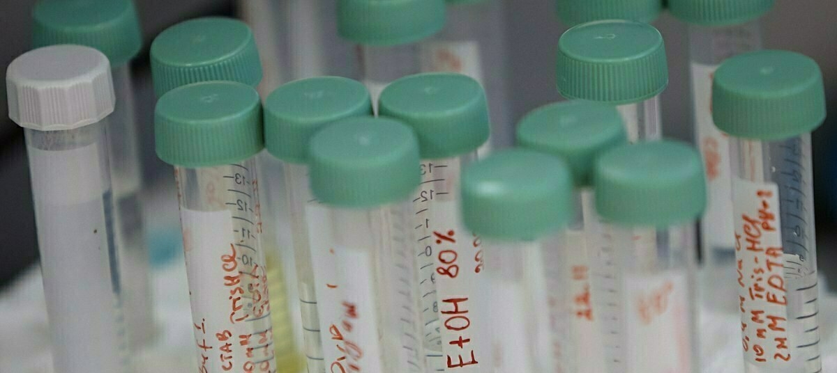 Эпидемиолог ответила на 8 вопросов о гепатите С