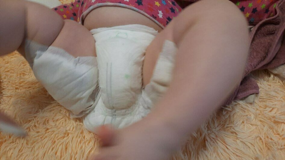В больнице ребенку удалили пузыри и сделали перевязку | Фото: Евгения
