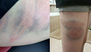 Запретили работать с детьми: в Калининграде приговорили к исправительным работам тренера, избившего воспитанника трубой  