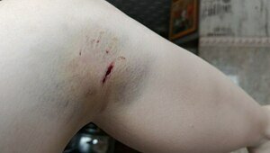 В Калининграде на студентку набросился крупный агрессивный пёс (видео) 