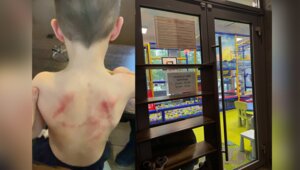 «Мы услышали жуткий крик сына»: в кафе Зеленоградска 5-летний мальчик получил травмы после издевательств подростков  