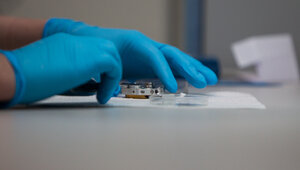 Глава Роспотребнадзора заявила о рекордном числе контактов людей с вирусом оспы обезьян