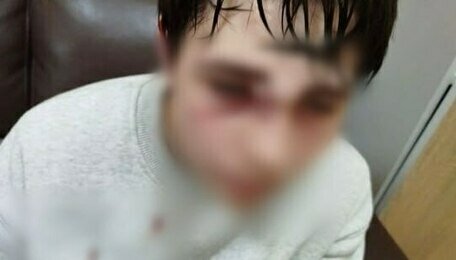 Подросток из посёлка под Калининградом перенёс операцию и оказался в гипсе после драки в школьной раздевалке  