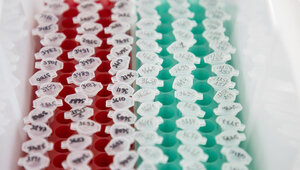 Минздрав утвердил новые правила тестирования на ВИЧ