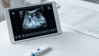 Тесты на овуляцию не показывают всю правду: что делать, если беременность не наступает