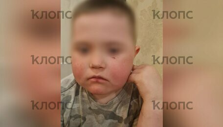 В Гурьевском районе суд оштрафовал мужчину, бросавшего камни и кости в ребёнка-инвалида  