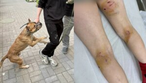 В калининградском дворе стаффорд набросился на девятилетних мальчиков, у обоих серьёзные раны (фото, видео)